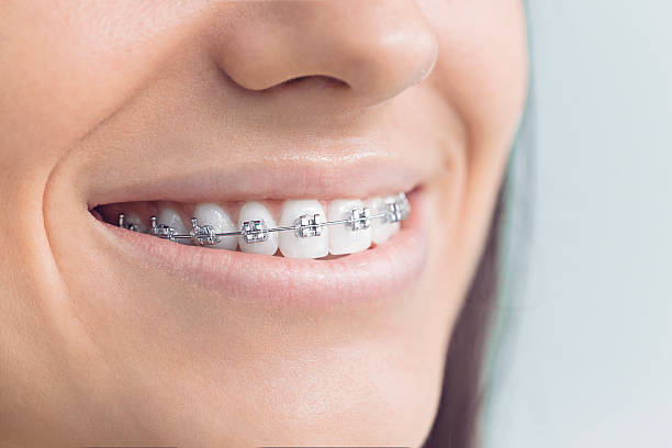 Full Mouth Reconstruction in West Haven, UT